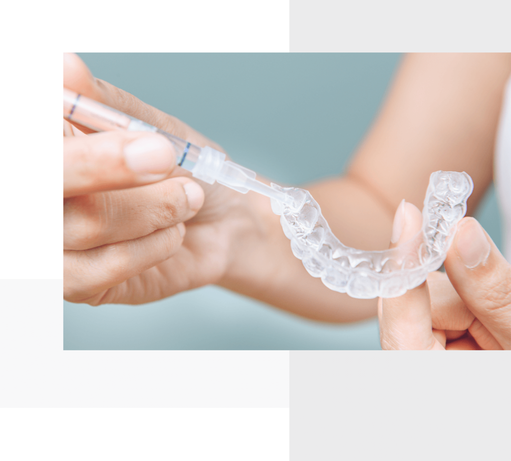 Can professional teeth whitening damage your teeth