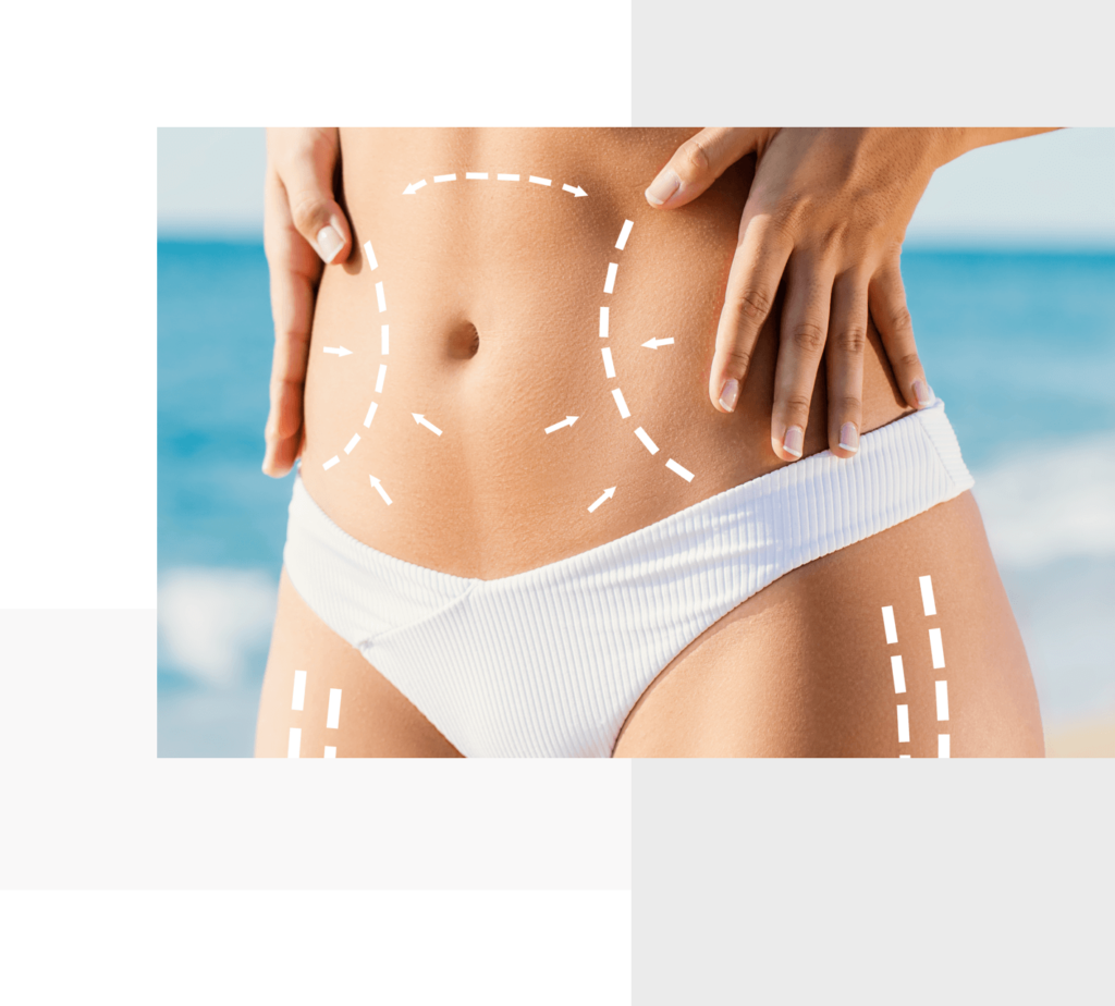 _bodybar cryo wellness alt Woman's flat stomach with her hands on her sides.