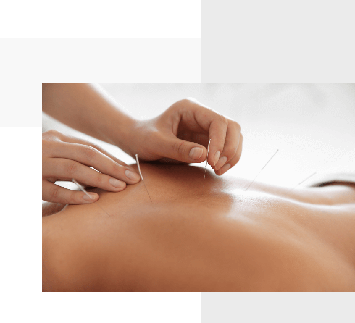 bodybar-acupuncture-book-now_3